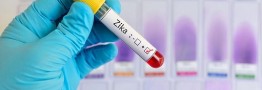 هشدار دانشمندان: ویروس زیکا تنها یک جهش با جرقه شیوع گسترده‌تر فاصله دارد