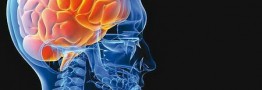 هر 5 دقیقه یک ایرانی سکته مغزی می کند