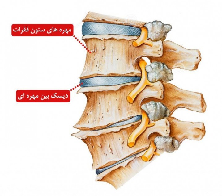 ساخت داربستی برای بافت لیفی دیسک بین مهرهای توسط محققان امیرکبیر