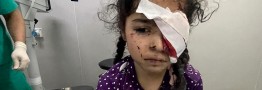 سازمان ملل متحد: حملات اسرائیل در غزه پاکسازی نژادی است